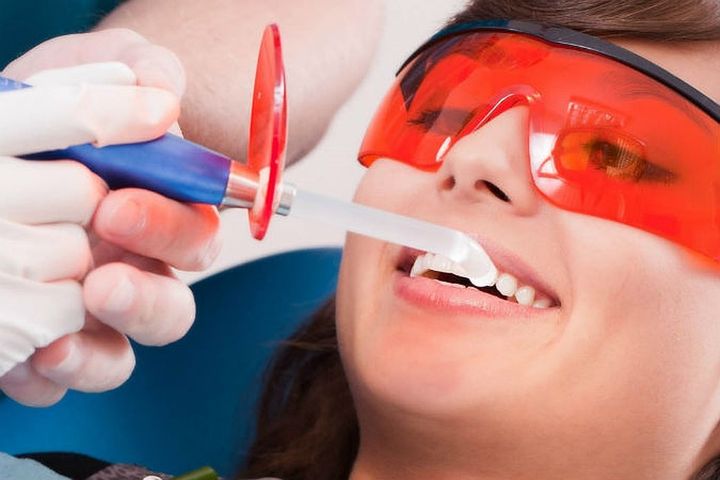 Процесс профессиональной чистки зубов