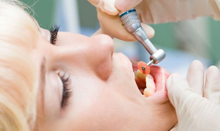 Сепарация зубов при лечение