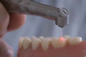 Лазерное лечение зуба