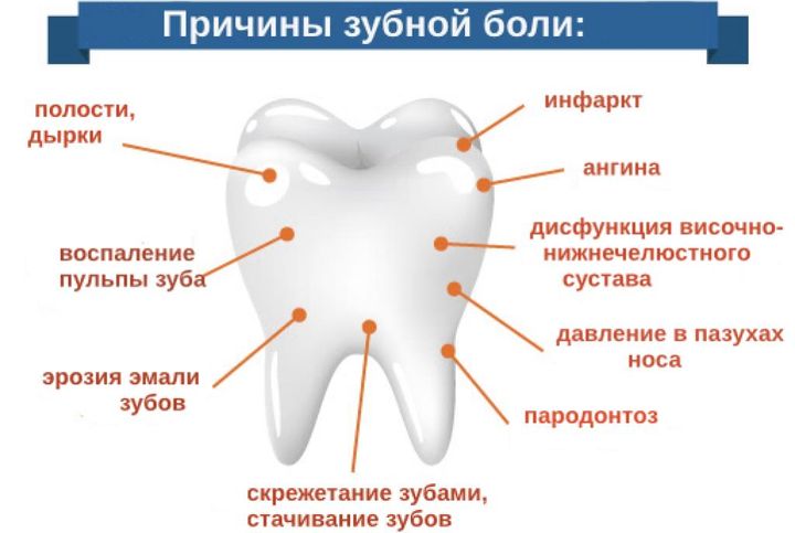 Причины возникновения зубной боли